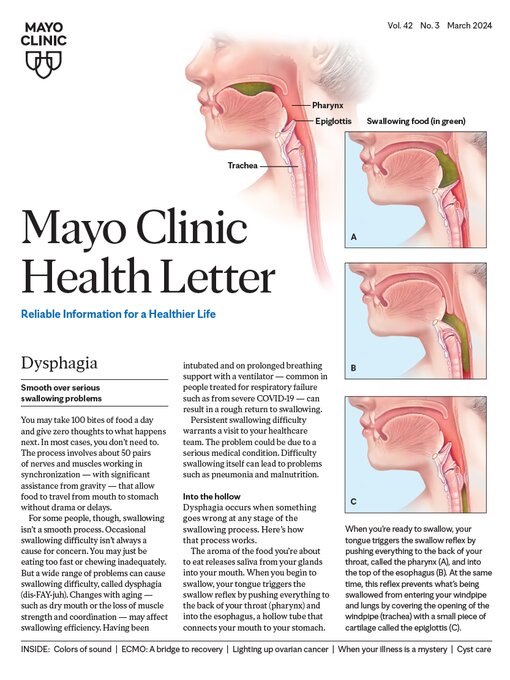 Title details for March 2024. Mayo Clinic Health Letter by Mayo Clinic - Available